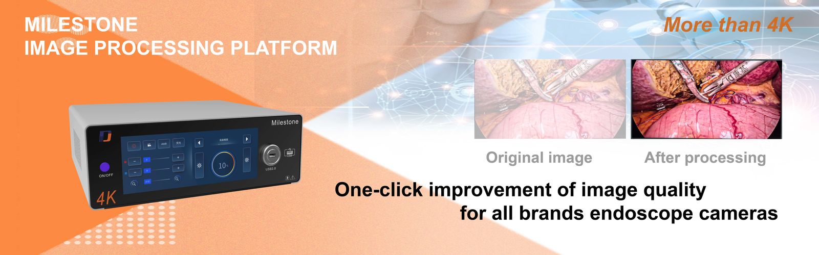 دوربین آندوسکوپی پزشکی