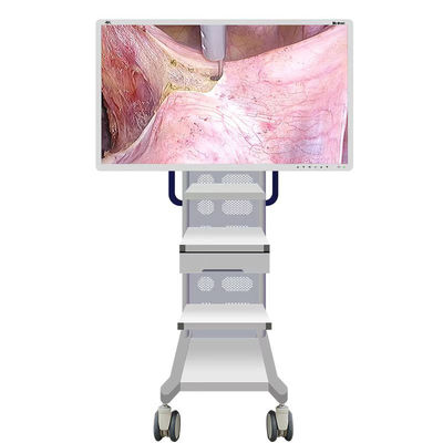 دوربین مانیتور آندوسکوپ پزشکی با صفحه نمایش 55 اینچی