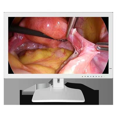 مانیتور پزشکی آندوسکوپ 1980x1200 RGBS 24 اینچی